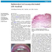 درمان  بیماری پروانه ای(Epidermolysis bullosa  ) با ریتوکسیماب